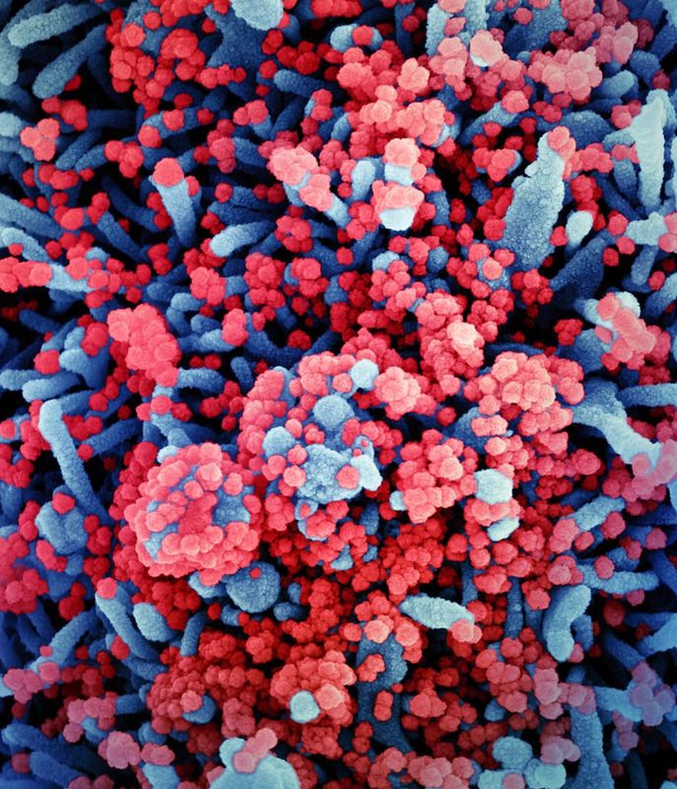 Imagem colorida artificialmente mostra célula, em azul, infectada pelo Sars CoV-2, em vermelho — Foto: NIAID