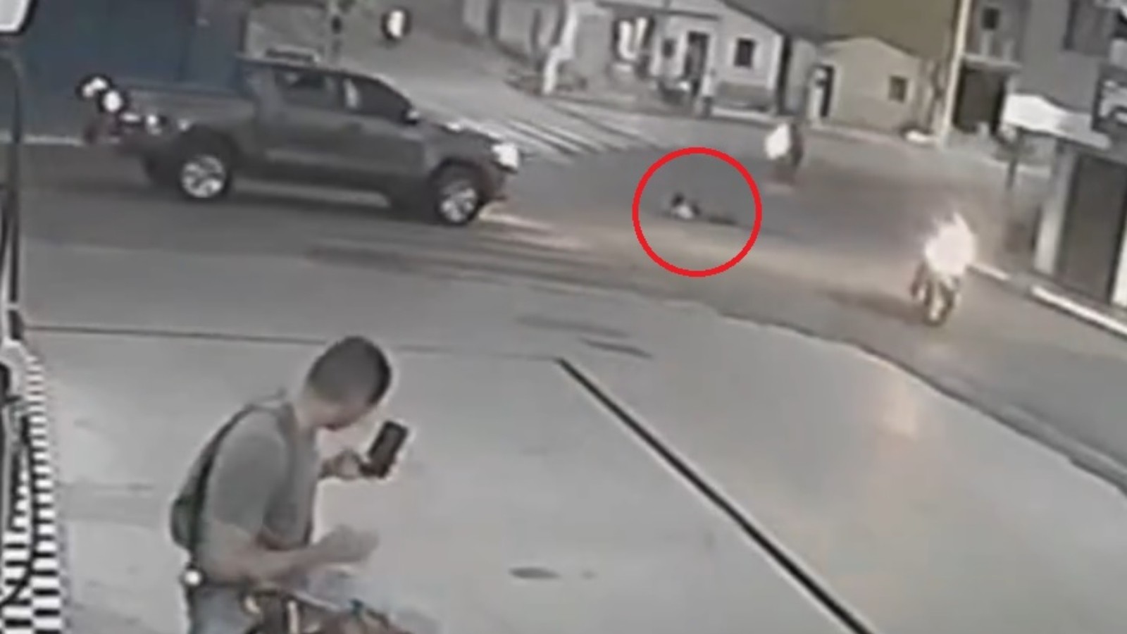 Homem que sobreviveu após caminhonete passar por cima dele mostra ferimentos; veja vídeo