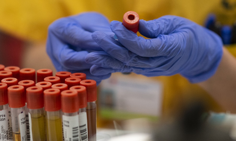 Testes PCR em laboratório de Madrid — Foto: Pierre-Philippe Marcou / AFP Photo