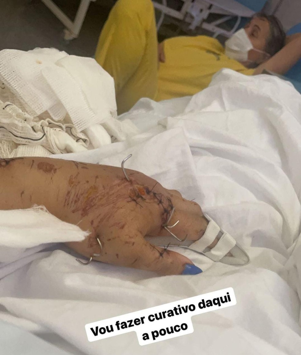 Aline se recupera do acidente no Hospital Regional de Cáceres — Foto: Reprodução