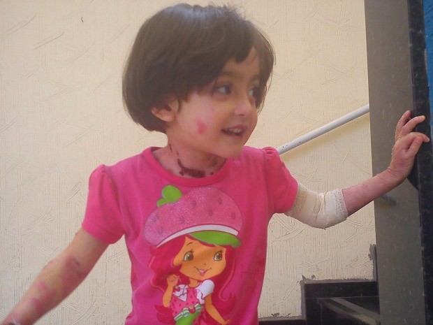 Raissa Victória tem 4 anos e sofre de epidermólise bolhosa (Foto: Arquivo pessoal)