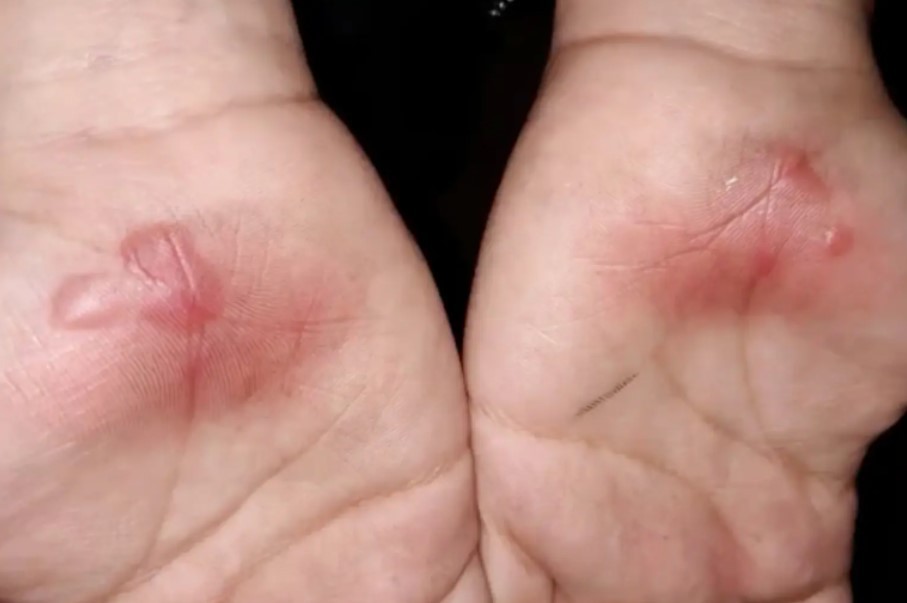 Alunos sofrem queimadura nas mãos após punição com exercício físico no asfalto quente (Foto: Reprodução/ YouTube)