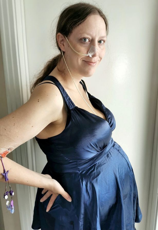 Michelle sofreu durante sua gravidez (Foto: Reprodução/Mirror)