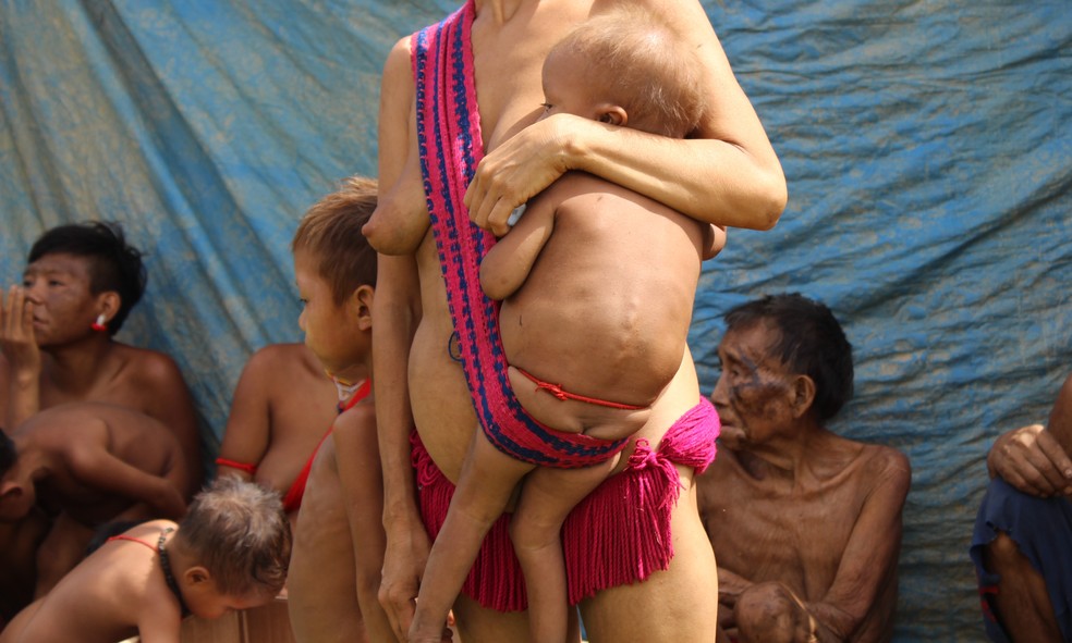 Mãe segura filho doente na comunidade Xaruna, Terra Yanomami. — Foto: Valéria Oliveira/g1/Arquivo