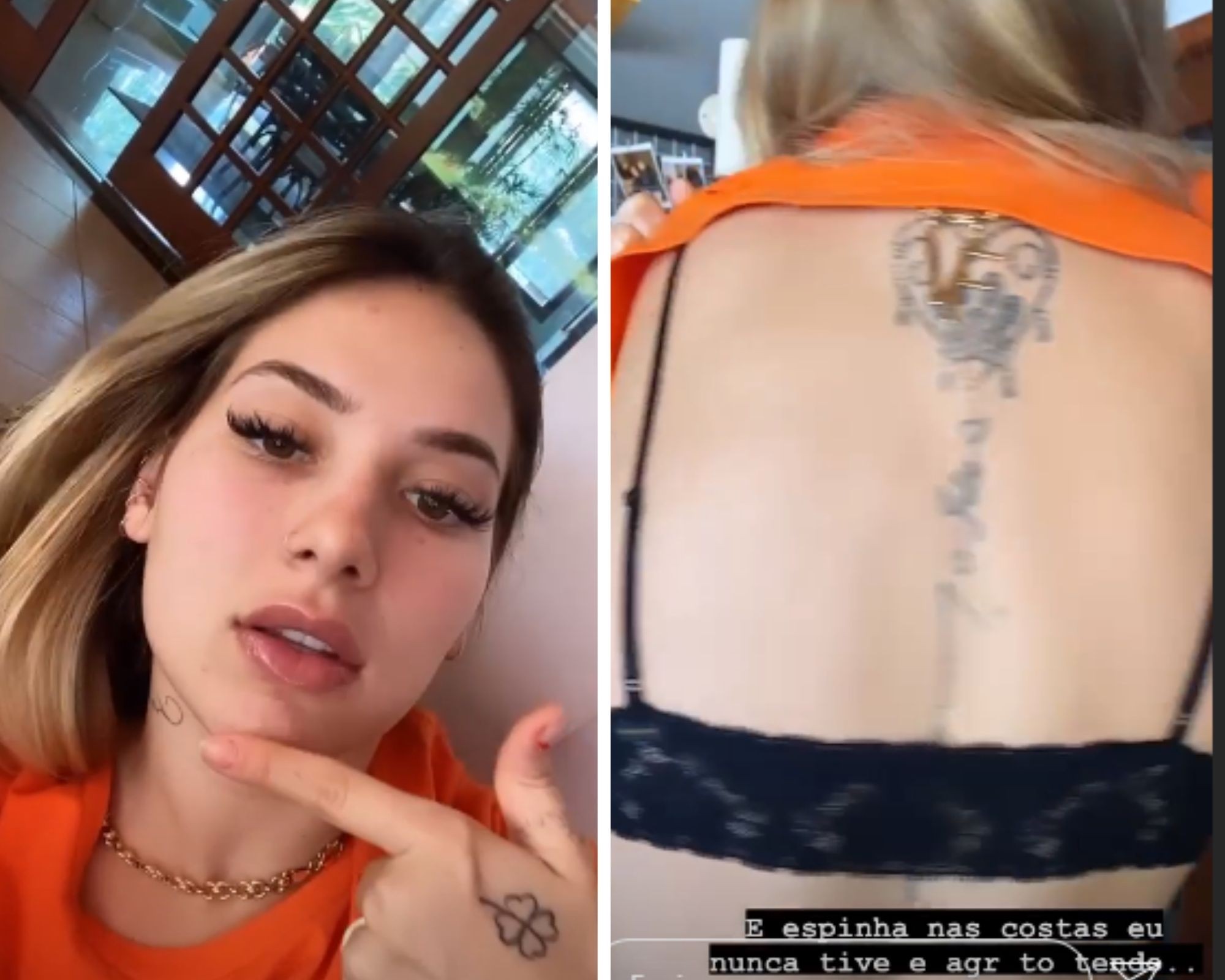 Virgínia Fonseca mostra que voltou a ter espinhas durante a gravidez (Foto: Reprodução/Instagram)