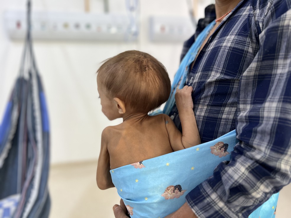 Menina Yanomami com desnutrição grave recebe tratamento no Hospital da Criança, em Boa Vista — Foto: Caíque Rodrigues/g1 RR