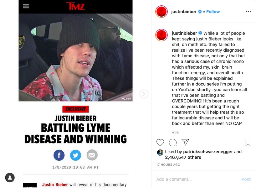 O post no qual o músico Justin Bieber revelou ter sido diagnosticado com Doença de Lyme (Foto: Instagram)