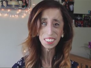 Lizzie Velasquez (Foto: Divulgação)