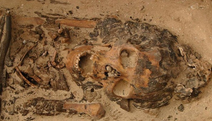 Incestos causaram deformidade maxilar em família real de séculos