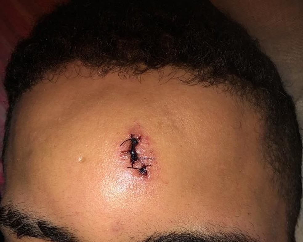 Um dos feridos passou por atendimento no hospital em Bauru após ser atingido pelos policiais — Foto: Arquivo pessoal 