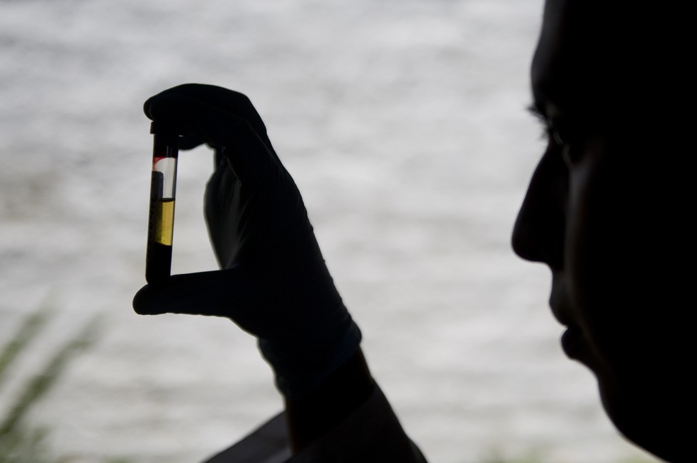  Cientista observa amostra de sangue em laboratÃ³rio (Foto: Luis Robayo/AFP)