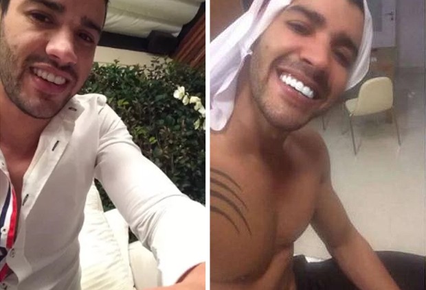 Antes e depois de dentes de Gusttavo Lima (Foto: Reprodução/Instagram)