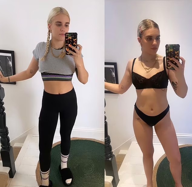Tigerlily Taylor mostrou seu antes e depois no Instagram (Foto: Reprodução / Instagram)