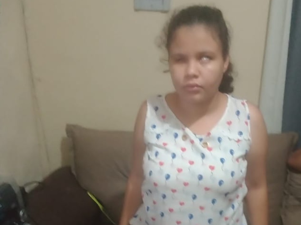 Ana Carolina precisa urgentemente de prótese para não ter infecção no olho — Foto: Arquivo Pessoal