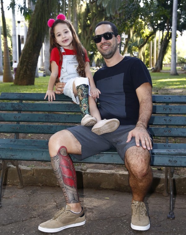 Pai Tatua Protese Na Perna Para Homenagear A Filha Um Jeito Descontraido De Ficar Igual A Ela Regiao Serrana G1