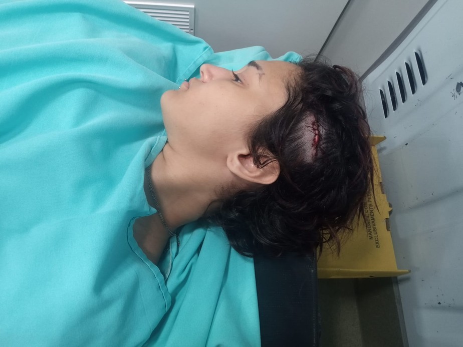 Jovem é agredida na cabeça com madeira após crítica a Bolsonaro em bar: Vai apanhar que nem homem