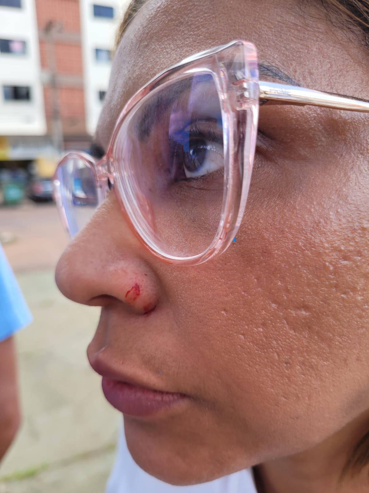 Enfermeira da rede pública do DF é agredida com tapa na cara após negar receita de remédio 'tarja preta'