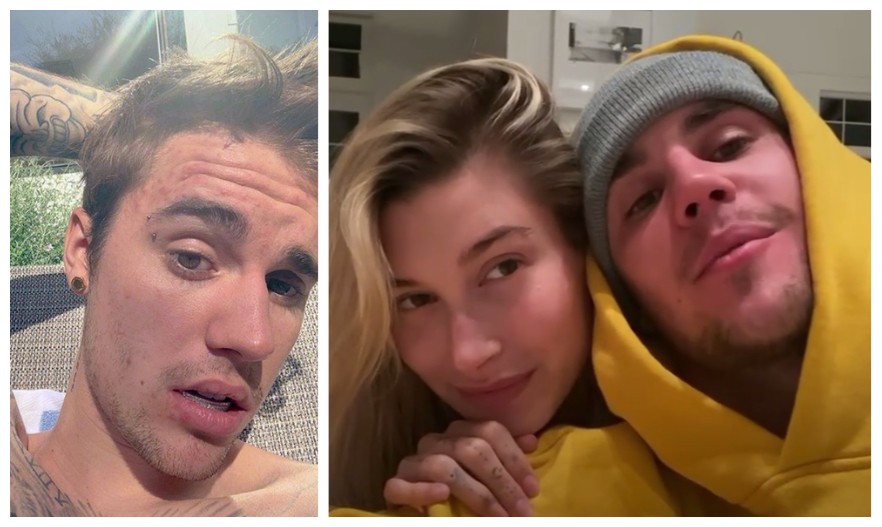 O músico Justin Bieber agradeceu à esposa pela melhoria de sua pele (Foto: Instagram)