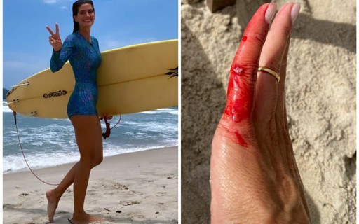 Isabella Fiorentino mostra machucado após dia de surfe