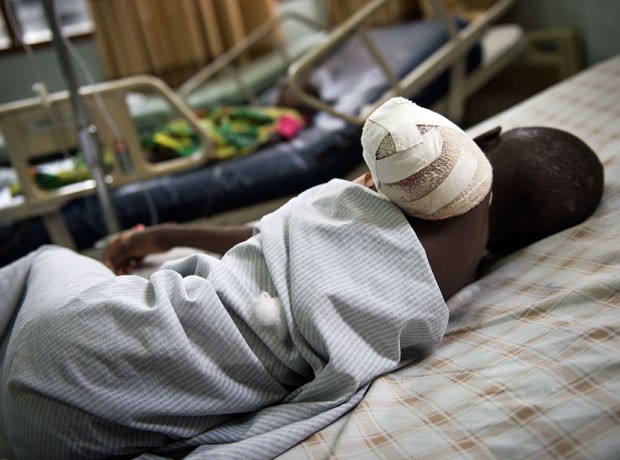 Kakule Elie, de 12 anos, teve que amputar o braço após ser atingido por uma bala perdida na cidade de Goma  (Foto: Phil Moore/AFP)