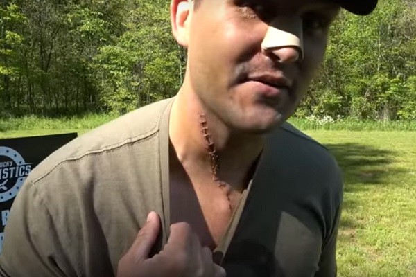 O youtuber Scott DeShields Jr. mostrando sua cicatriz no pescoço decorrente da explosão do rifle (Foto: YouTube)