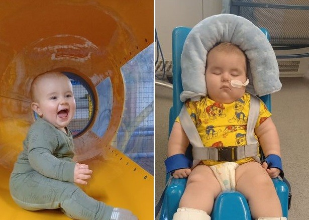 Blake antes e depois de sofrer o AVC, em seu primeiro aniversário (Foto: Reprodução/ Yorkshire Live)