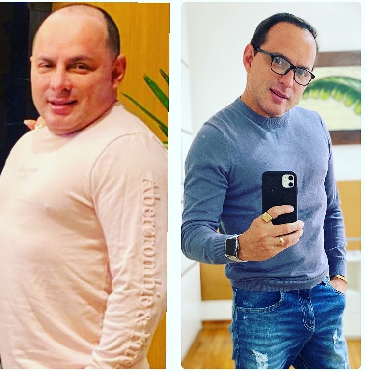 Antes e depois de Esdras de Souza, marido da cantora Gretchen (Foto: Reprodução/Instagram)
