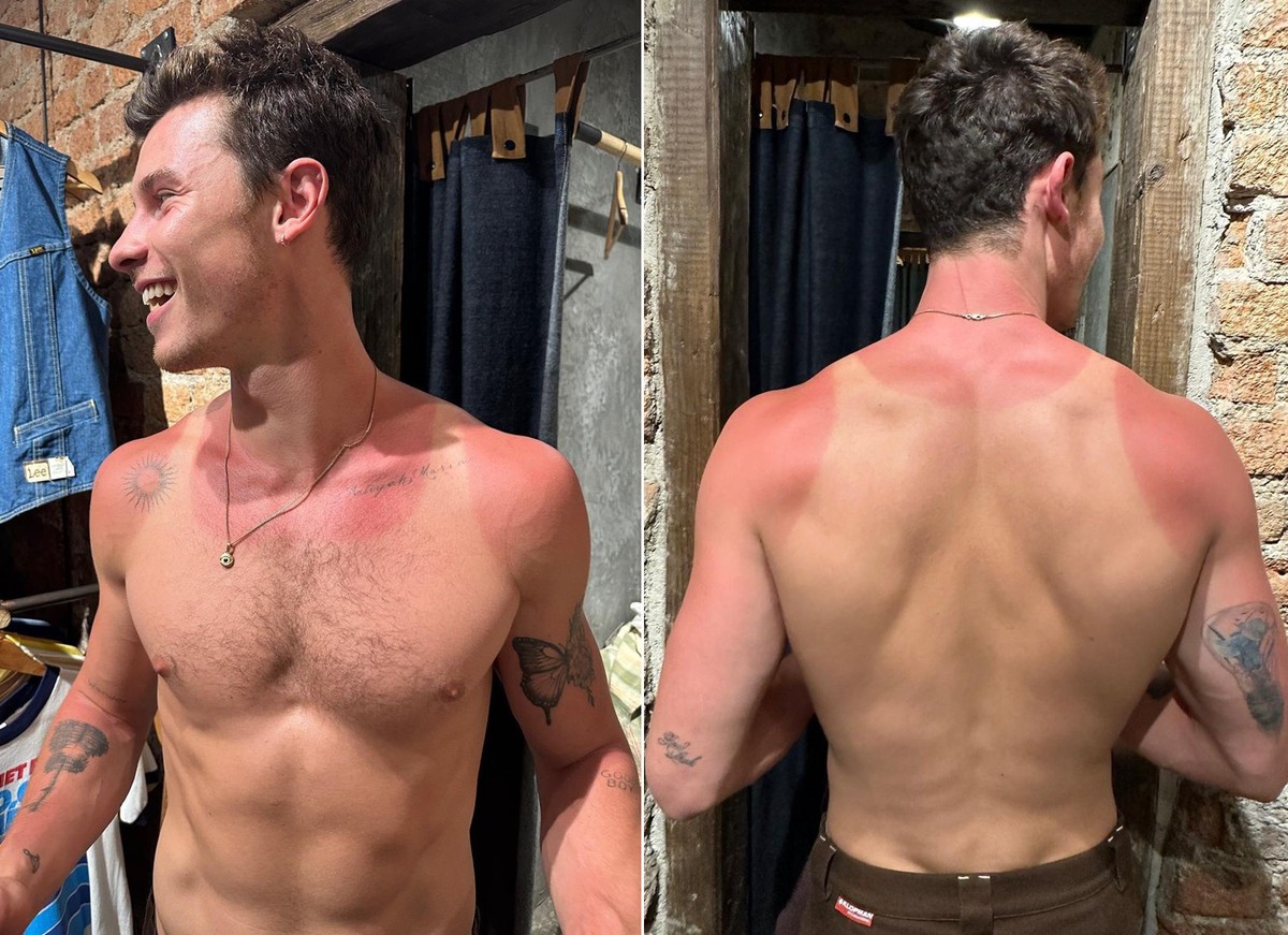 Mientras corre, Shawn Mendes ataca como turista en México y muestra ‘marca de sol’ |  Noticias