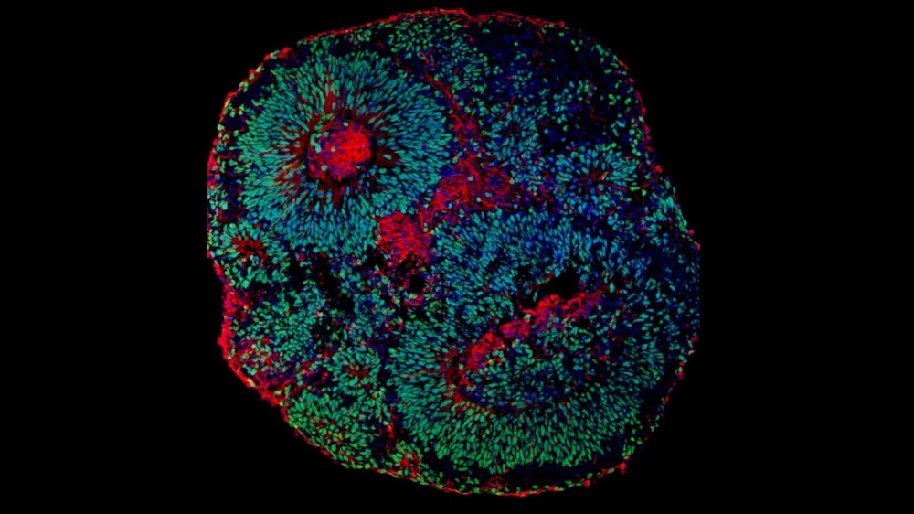 Imagem de microscopia mostrando o aspecto de um organoide cerebral derivado de células humanas. As células em verde são os progenitores de neurônios e as células em vermelho são os neurônios (Foto: Fábio Papes/Unicamp)