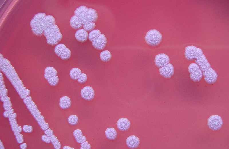 Sprays aromáticos são recolhidos nos EUA após infecções por bactéria letal. Acima: colônias de Burkholderia pseudomallei (Foto: Gavin Koh/Wikimedia Commons)