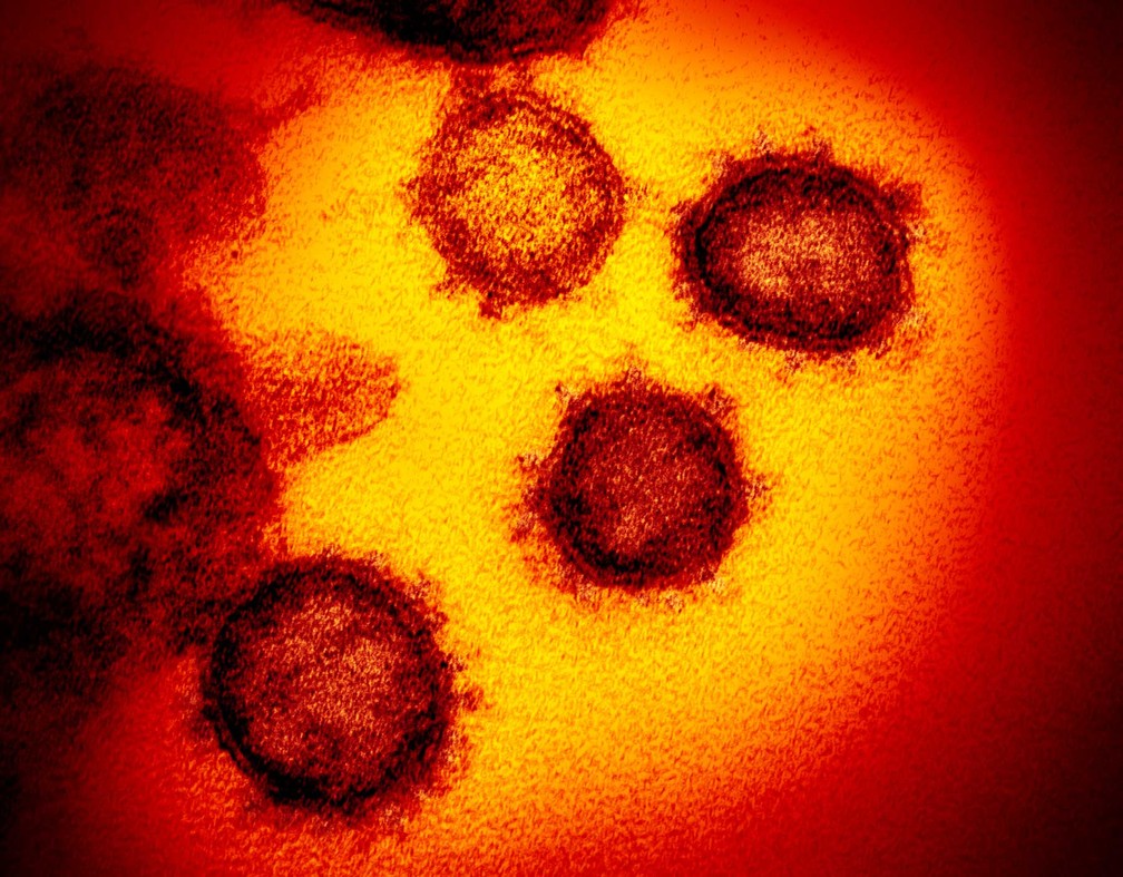 Resultado de imagem para coronavirus