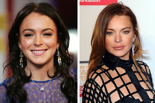 Lindsay Lohan em 2005 e agora (Foto: Getty Images)