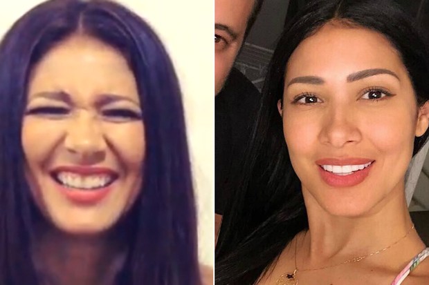 Simaria antes e depois das lentes de contato nos dentes (Foto: Reprodução/Instagram)