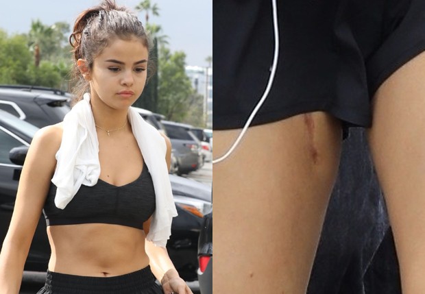 Selena Gomez mostra cicatriz na coxa (Foto: BackGrid)