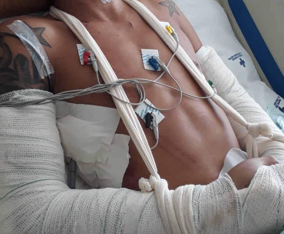 Agressor internado no hospital. (Foto: Divulgação/ PM)