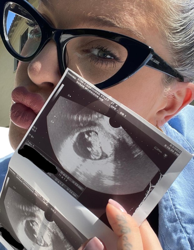 Kelly Osbourne anuncia gravidez (Foto: Reprodução/Instagram)
