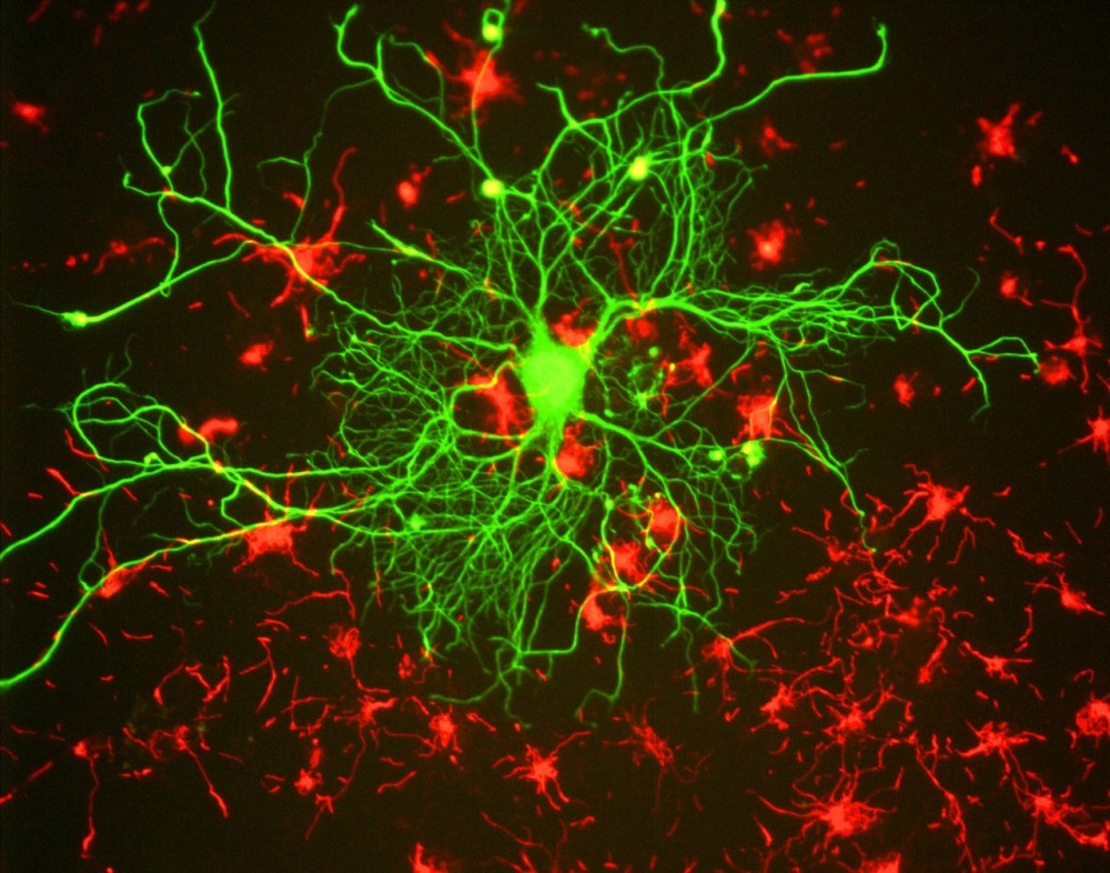Grupo da Unicamp usou o mapeamento de proteínas para demonstrar como níveis anormais do neurotransmissor glutamato comprometem o funcionamento de células nervosas (Foto: Gerry Shaw/Wikimedia Commons)