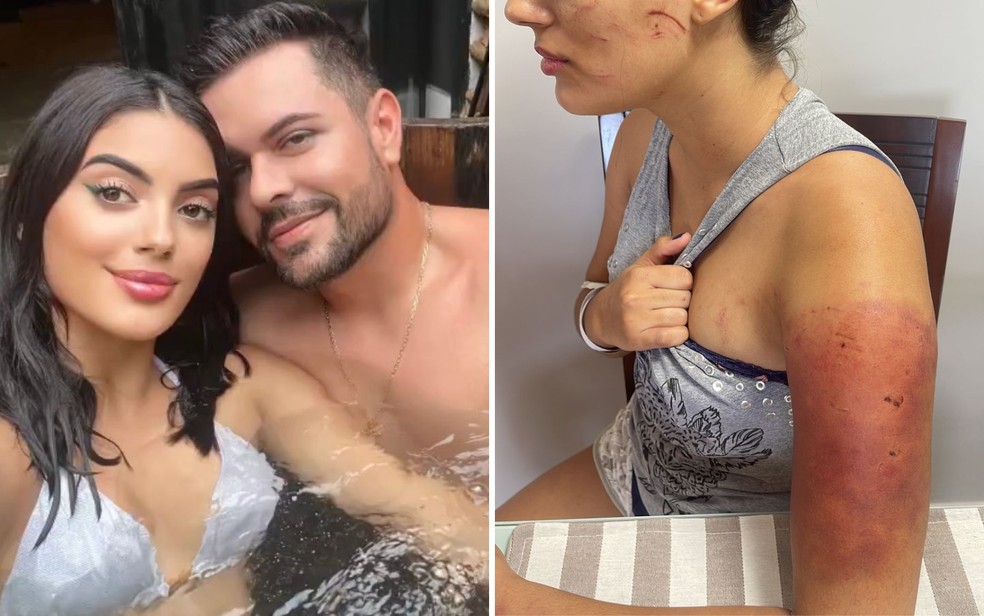 À esquerda, Isabella Lacerda ao lado do namorado Thiago Brandão Abreu. À direita, a jovem com hematomas após agressão — Foto: Arquivo pessoal/Isabella Lacerda e montagem/g1
