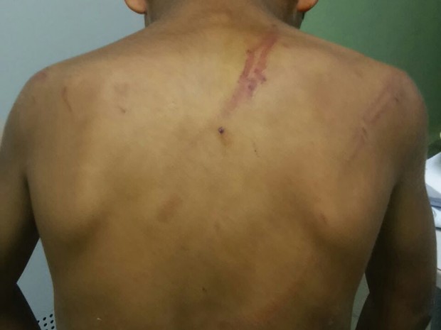 Criança agredida em Altinho, Agreste de PE (Foto: Divulgação/ Polícia Civil)