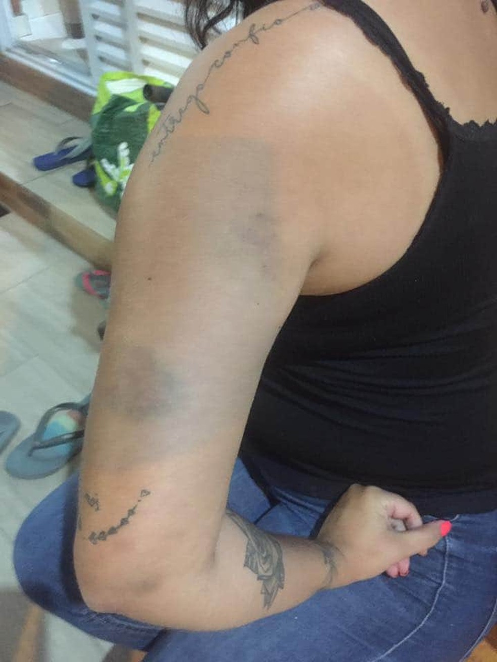 Vítima foi encaminhada ao pronto-socorro após agressões sofridas pelo namorado em São Vicente, SP — Foto: Reprodução/Facebook