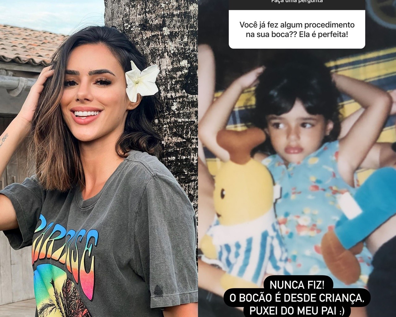 Bruna Biancardi nega ter feito procedimento na boca: 'Desde criança' -  Revista Marie Claire | Celebridades