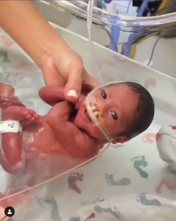 A pequena Olivia Rose tinha apenas duas semanas quando fez a primeira sessão de hidroterapia (Foto: Reprodução/Instagram)