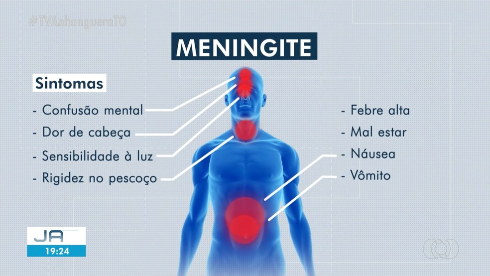 Meningite Sintomas Diagnóstico Tratamento E Prevenção O Liberal Hot Sex Picture 0453