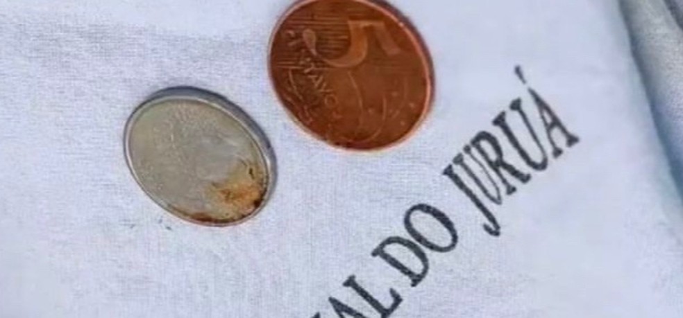 Duas moedas foram retirada da garganta do menino no interior do Acre  — Foto: Arquivo pessoal 