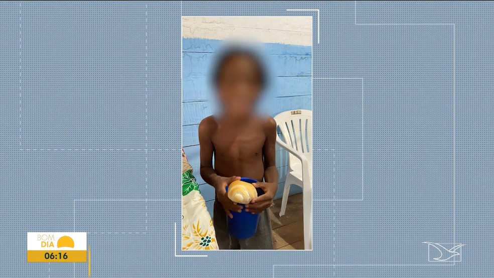 MA perde só para a BA em número de crianças internadas por desnutrição — Foto: Reprodução/TV Mirante