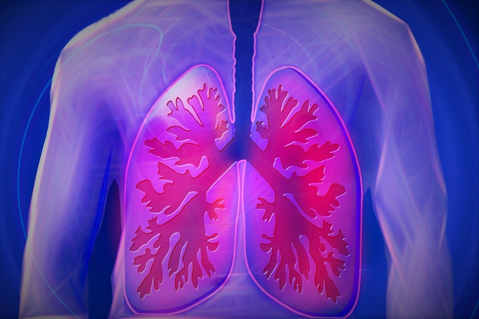 Testes com inteligência artificial mostraram ótimo desempenho da tecnologia na detecção de câncer de pulmão (Foto: Pixabay)