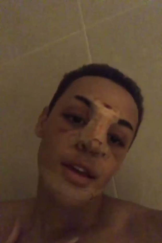 Pabllo Vittar Nega Namoro E Explica Cirurgia No Nariz Vogue Gente Ser mamífero sí, por la rama. pabllo vittar nega namoro e explica