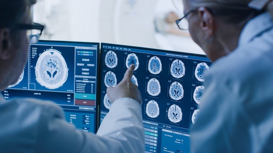 Nova técnica permite diagnosticar Alzheimer com mais precisã