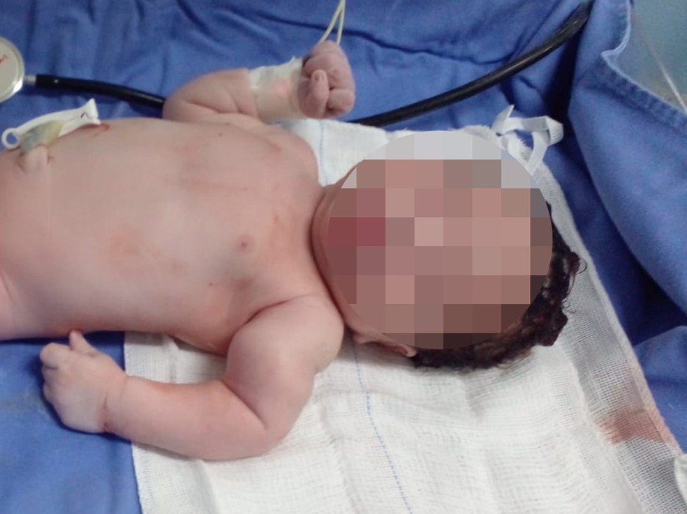 Pai diz que médicos quebraram braço de recém-nascido durante parto em Salvador — Foto: Reprodução/TV Bahia