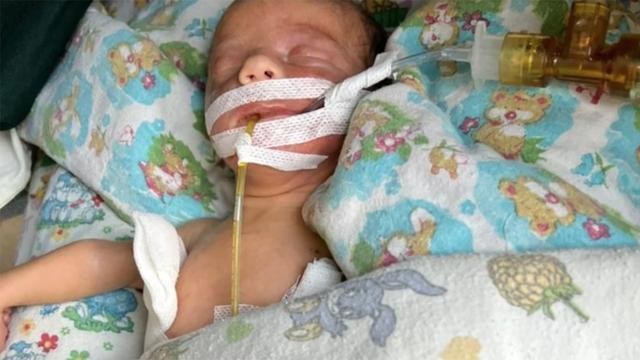 Alba, filha de australianos, está internada em uma UTI Neonatal na Ucrânia depois de nascer prematuramente na 28ª semana de gestação (Foto: Arquivo pessoal)